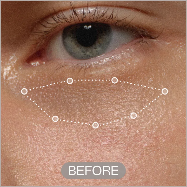 Under-eye skin before RAWDOG Eye Cream