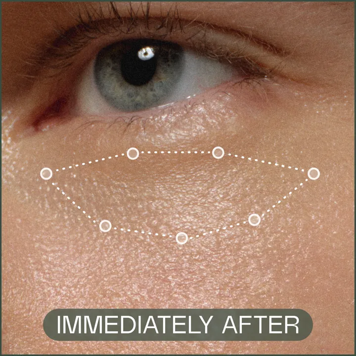 Under-eye skin immediately after RAWDOG Eye Cream